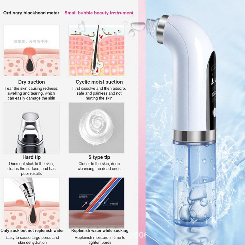 Features of Friday Sweets Blackhead Remover 